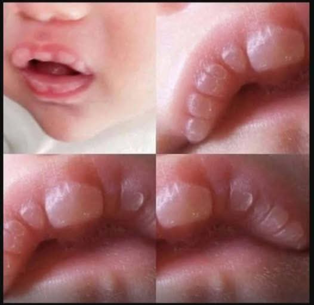 If your baby has these marks it means… See more
