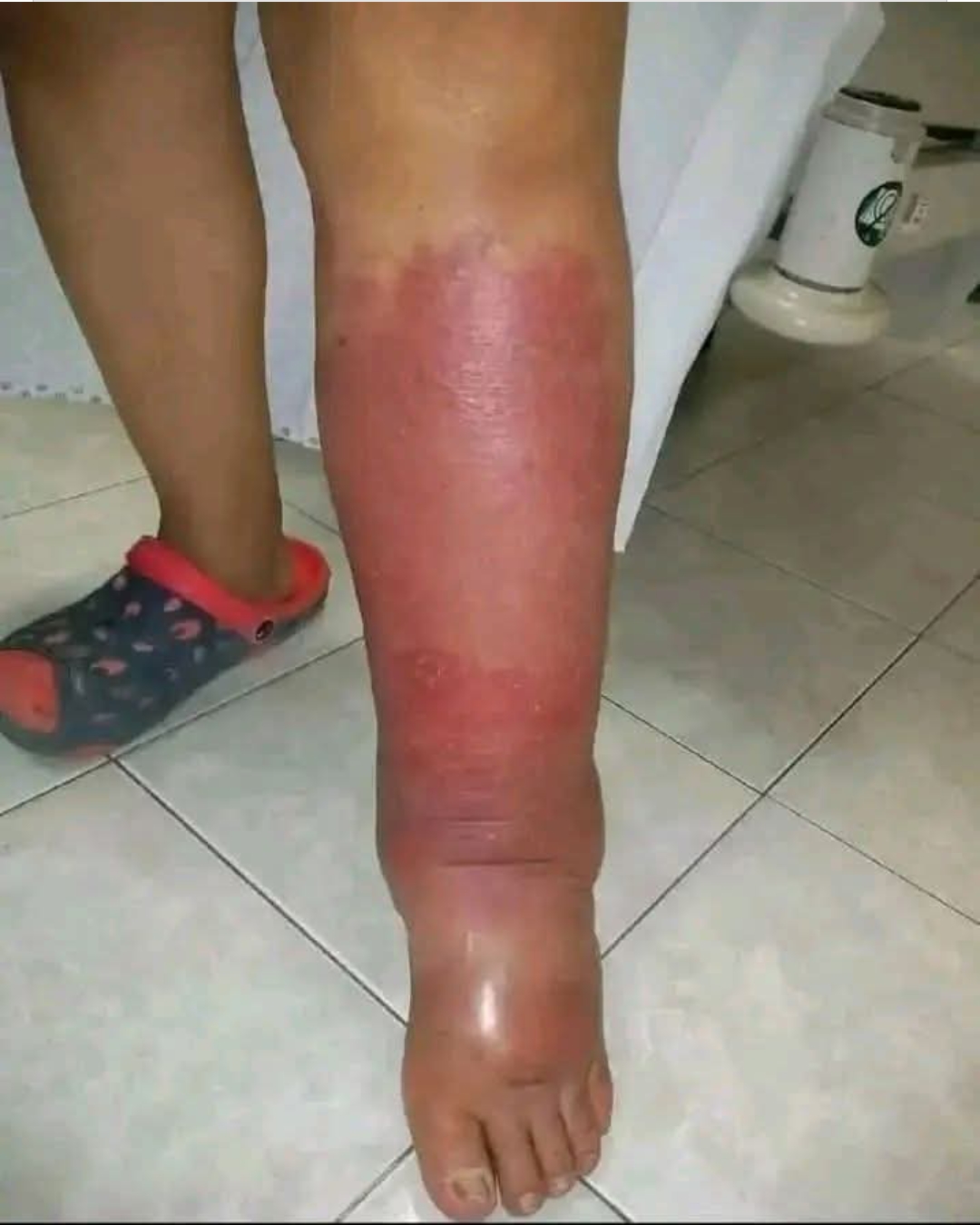 These are the signs that he is cr… See more